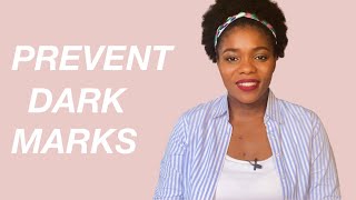 How to Prevent and Treat Post Inflammatory Hyperpigmentation on Dark Skin | Dr Janet