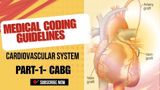 medical coding -cardiovascular system-CABG - part-1