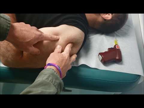 RT Clinic: Quick Hit Tutorial- Intraosseous IO Access Placement