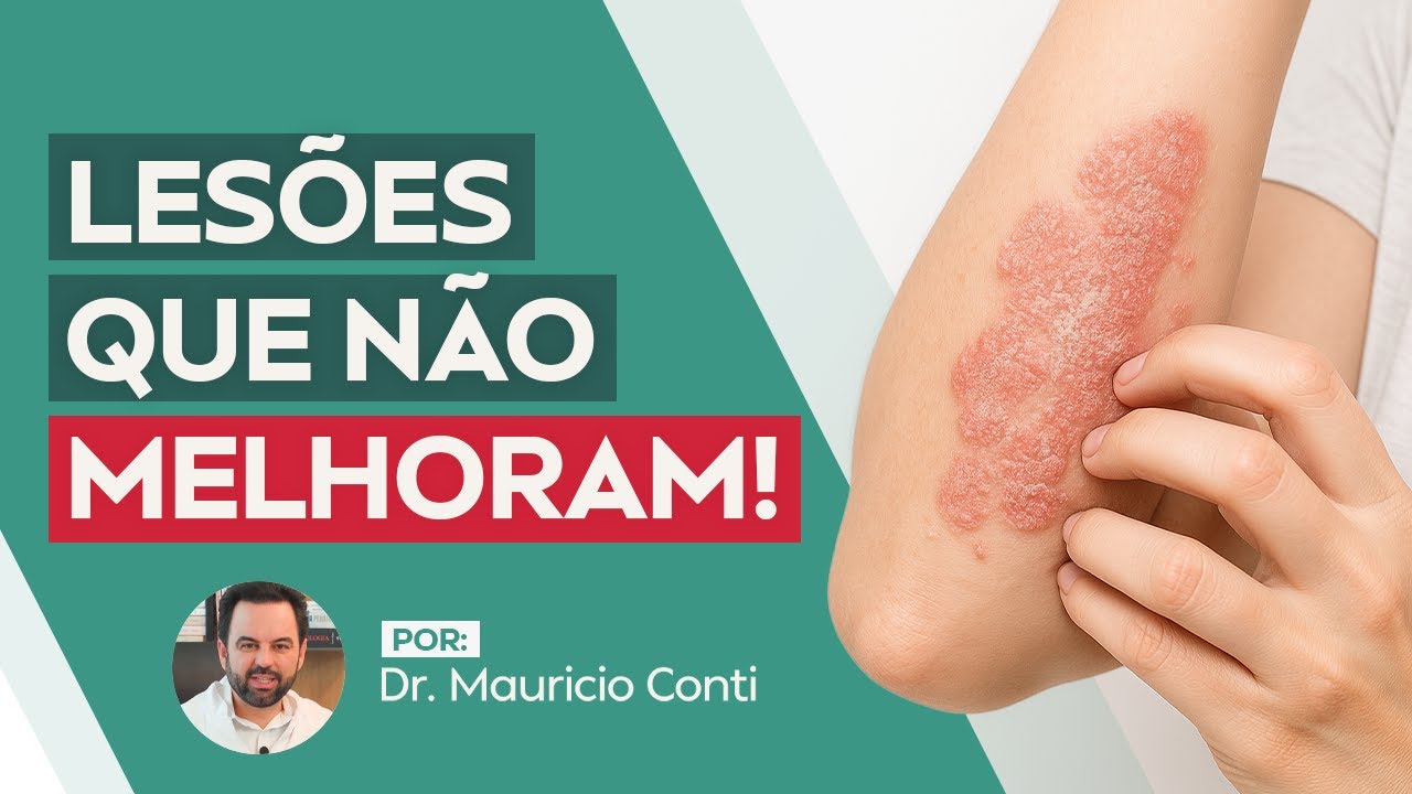 Dr. Maurício Conti — vídeo 7