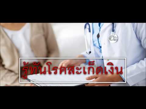 กับการ mumie โรคสะเก็ดเงิน คุณสามารถกลากอาบแดด