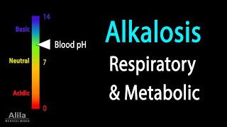Alkalosis, Respiratory and Metabolic