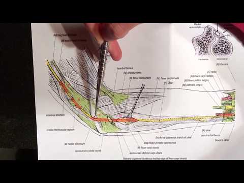 Ulnar Nerve Compression Sites / Cubital Tunnel Syndrome