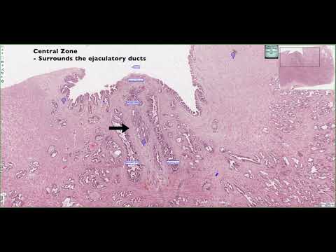 Rhodiola rosea din prostatită