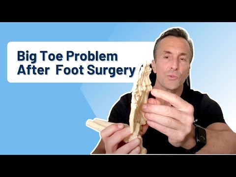 Big Toe Joint Replacement vs Joint Cleanup Ask Dr Moore
