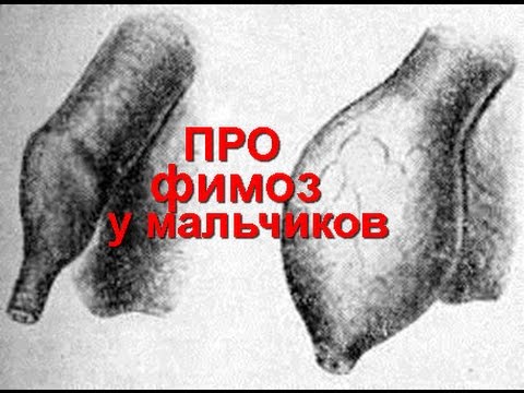 ซื้อเครื่องมือในมินสก์เพื่อเพิ่มความแข็งแรง Hirudotherapy ในการรักษาความอ่อนแอ