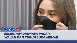 Download lagu Selebgram Cantik Asal Sidoarjo Alami Luka Disekujur Tubuh Akibat Dianiaya Pacarnya - LIP 26/12 mp3