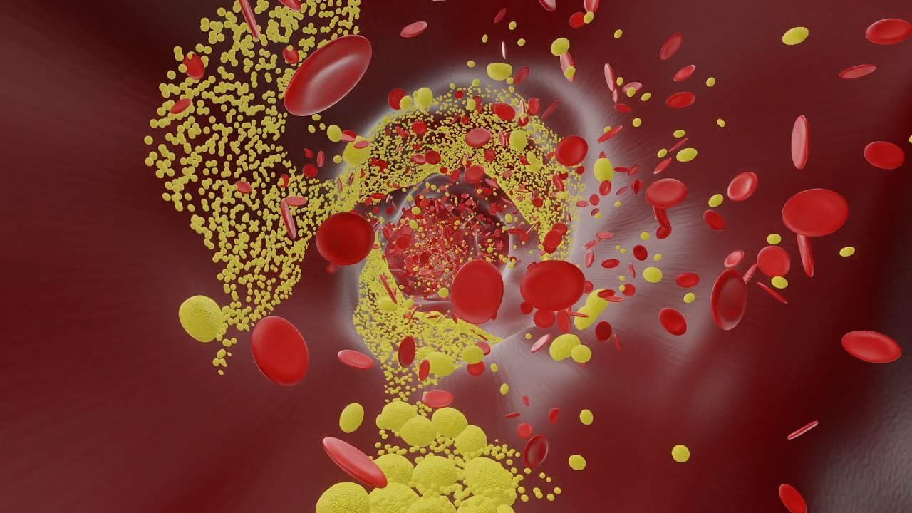 Strategies to break the heart disease and diabetes link