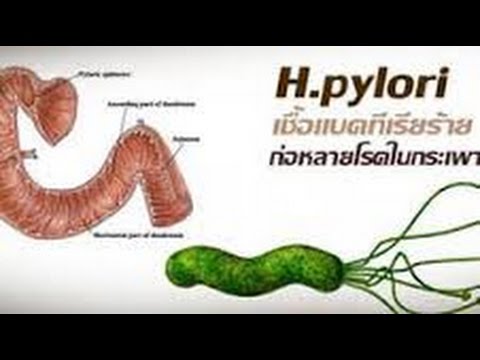 การรักษาโรคสะเก็ดเงินบนทะเลสาบ ครีมสำหรับโรคสะเก็ดเงินด้วยวิตามิน D ราคา