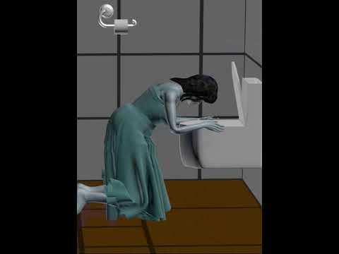 Why Omitting in the early stages of pregnancy ( 3D Animation )