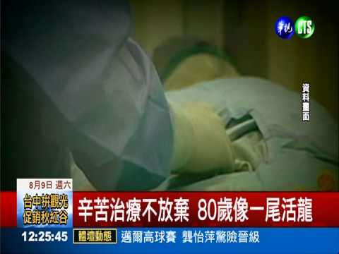 肝病篩檢治療 80歲病友活跳跳