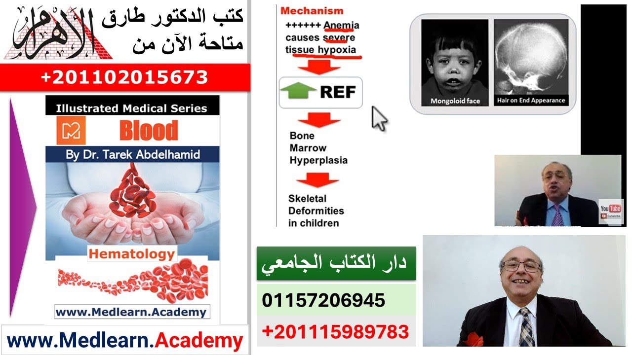 Thalassemia  #cme #internal_medicine #medical #medicalstudent  #usmle #محاضرات_باطنة