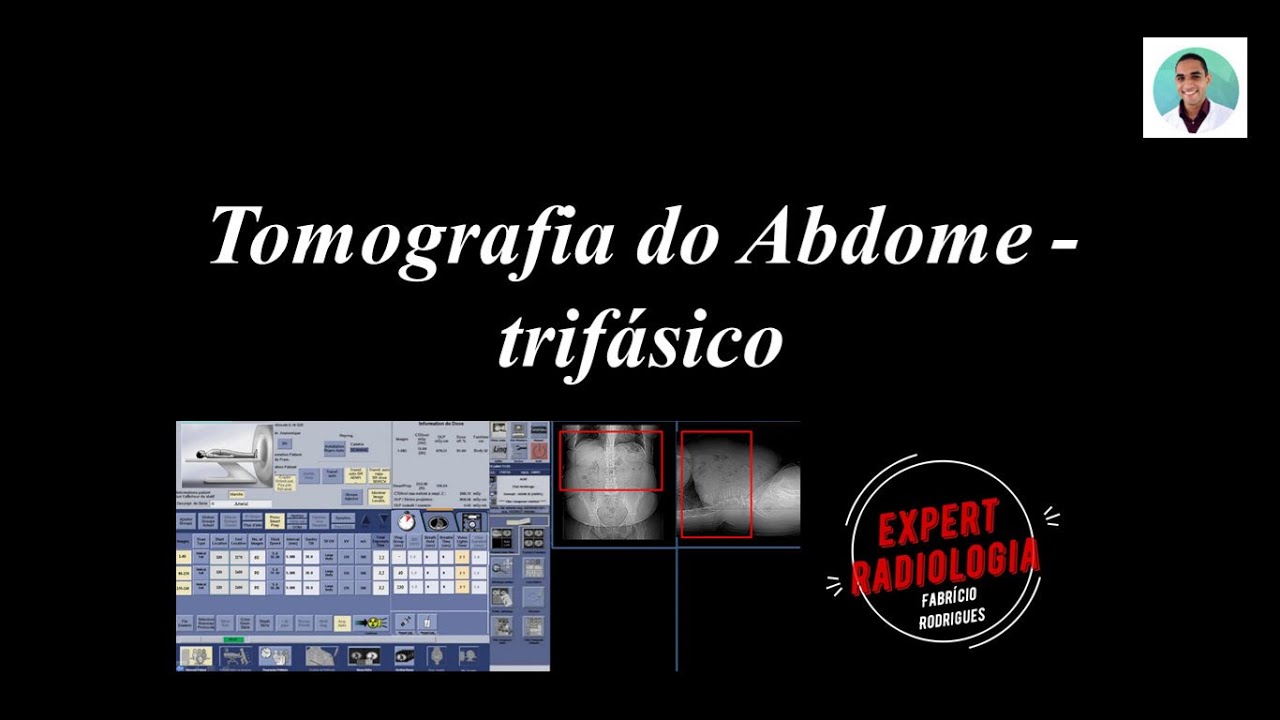 Tomografia do Abdome - TRIFÁSICO