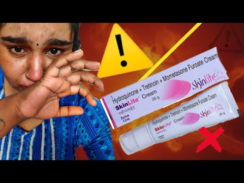 Skinlite cream review