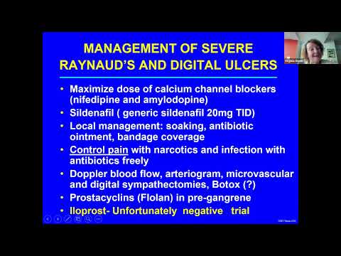 Systemic Sclerosis: A Clinical Update on New Treatment with a Focus on African Americans