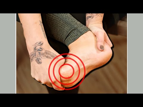 𝟮 𝗘𝘅𝗲𝗿𝗰𝗶𝘀𝗲𝘀: Hallux Rigidus Self Treatment // Big Toe Arthritis Exercises