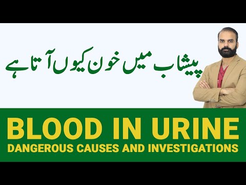 BLOOD in Urine | Peshab Mein Khoon Aane Ki Wajah in Urdu/Hindi