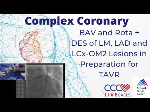 BAV and Rota + DES of LM, LAD and LCx-OM2 Lesions in Preperation for TAVR - CCC Live Dec 2016