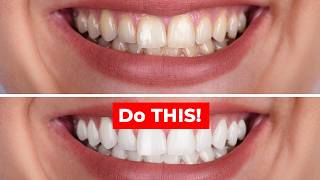 You’ve Been Whitening Wrong This Whole Time