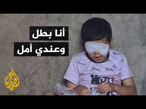 محمد البطل.. قصة طفل فقد عينيه إثر القصف الإسرائيلي