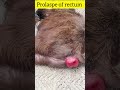 Prolaspe Of Rectum L Dr Umar Khan
