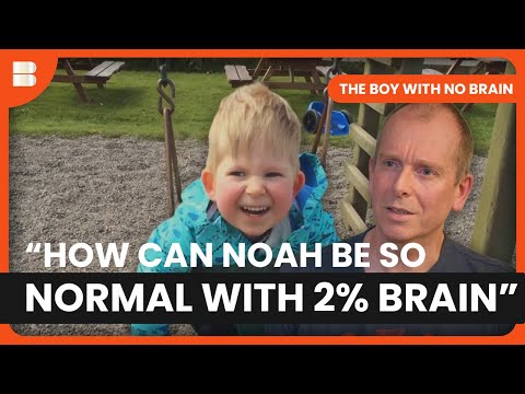 "He's Doing Everything They Said He Never Would" | The Boy With No Brain | Medical Documentary