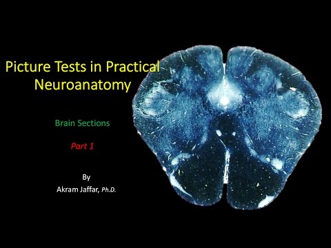 Picture Test in Neuroanatomy Brain Sections 1