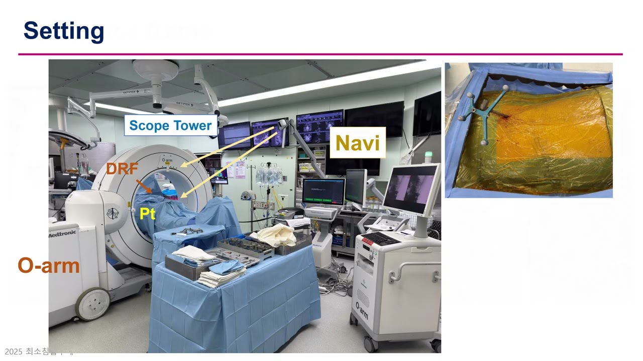 Lumbar Decompression Thumbnail