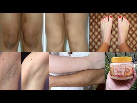 How To Lighten Your Dark Body Parts - Lighten Dark Knees, Elbows & Underarms Video