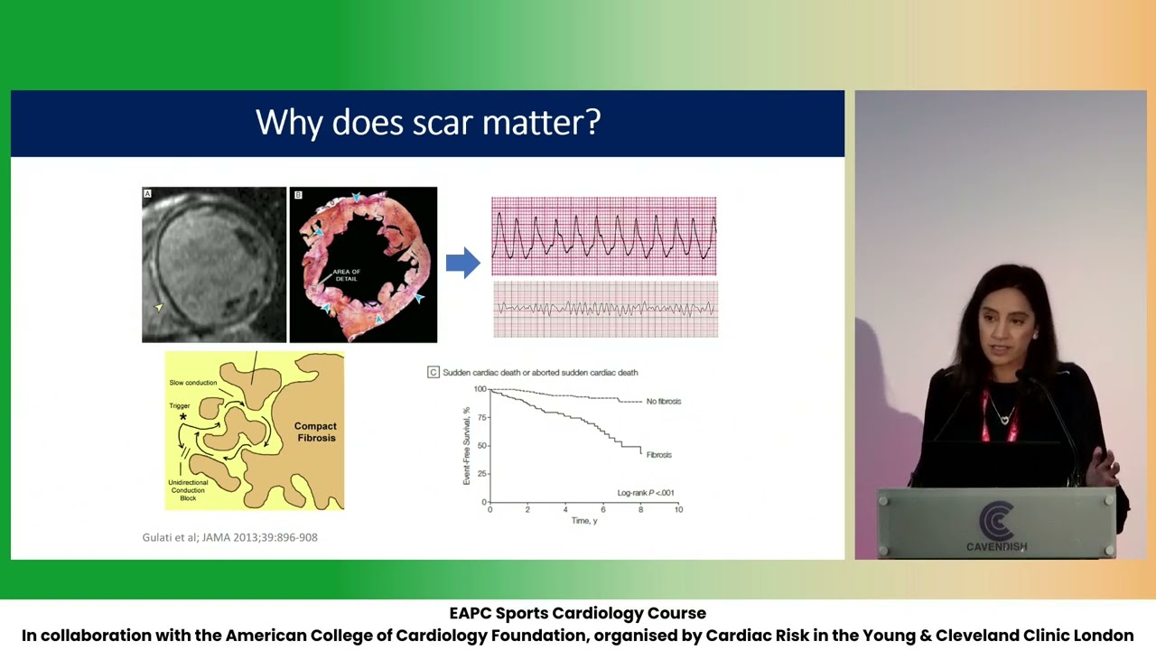 When to worry about scar on MRI - S  Gati