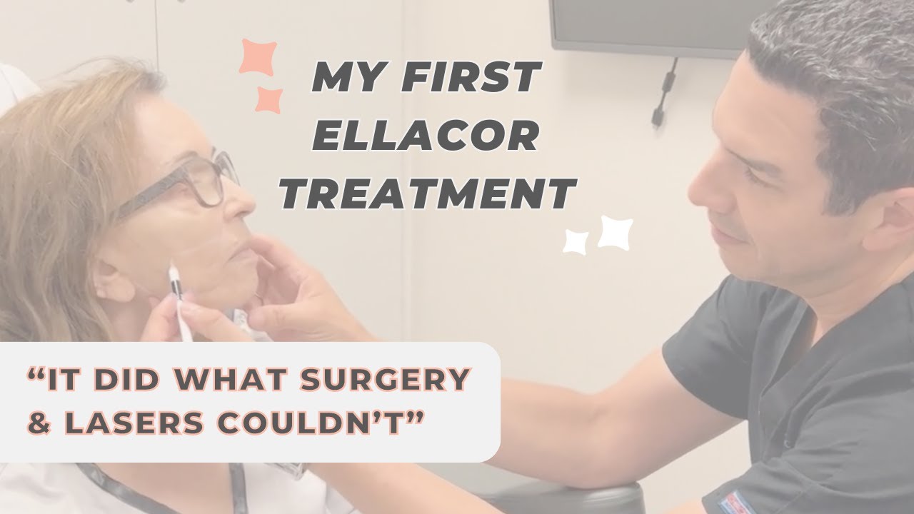 At 79, Marie Says Ellacor Can Finally Treat What Plastic Surgery & Lasers Cannot