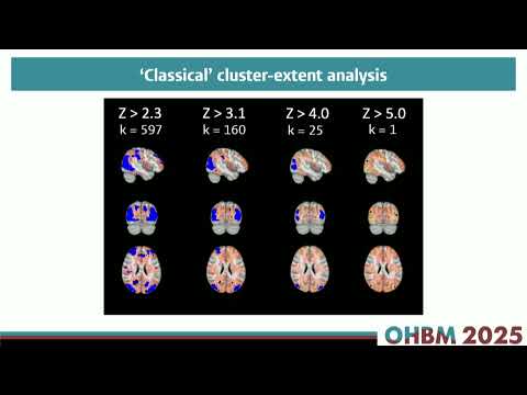 OHBM 2025 | Educational Course | Where is my signal? Spatial information in fMRI analysis | Part 3
