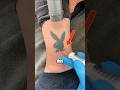 How Laser Tattoo Removal Is Done Hwclinicbrugge