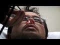 Inhaled Toothpick Part 1 Bizarre ER