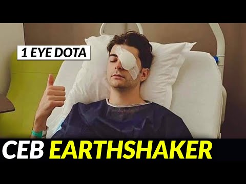 Ceb plays Dota with 1 eye after Surgery? Still the Best Offlaner