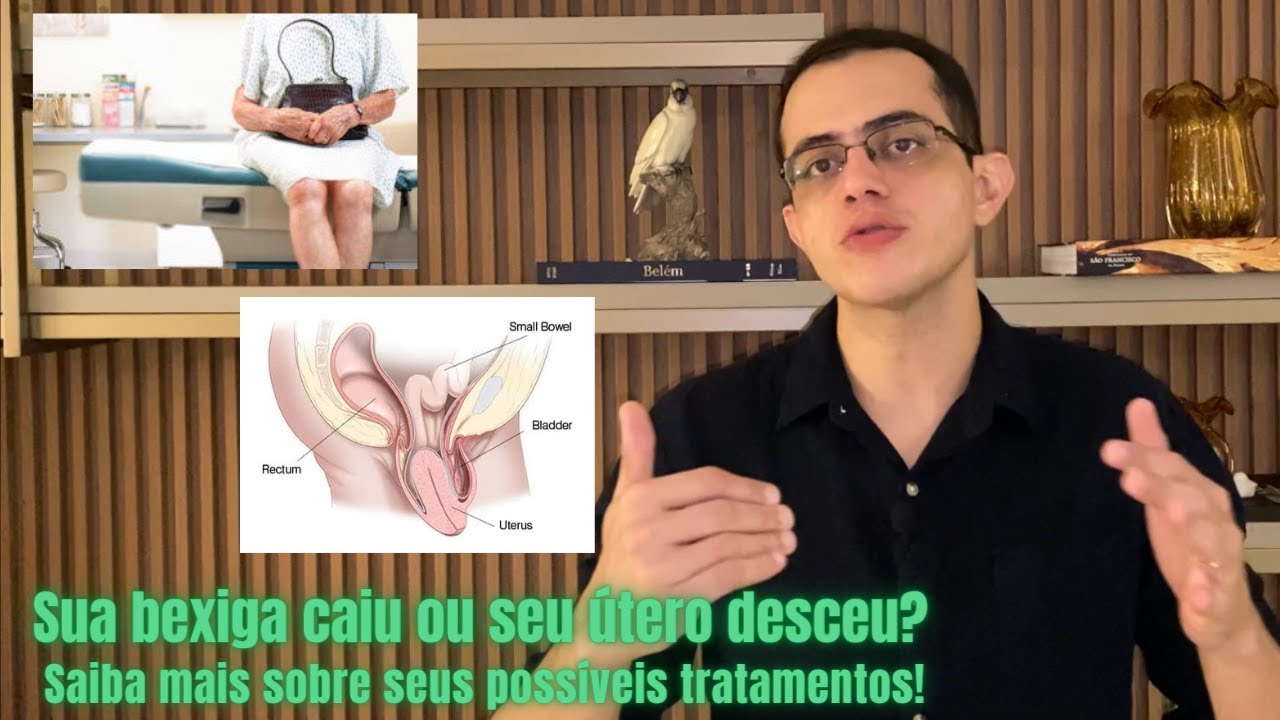 Principais tratamentos para os prolapsos pélvicos (útero e bexiga)! [Fisioterapia, cirurgia, tela]
