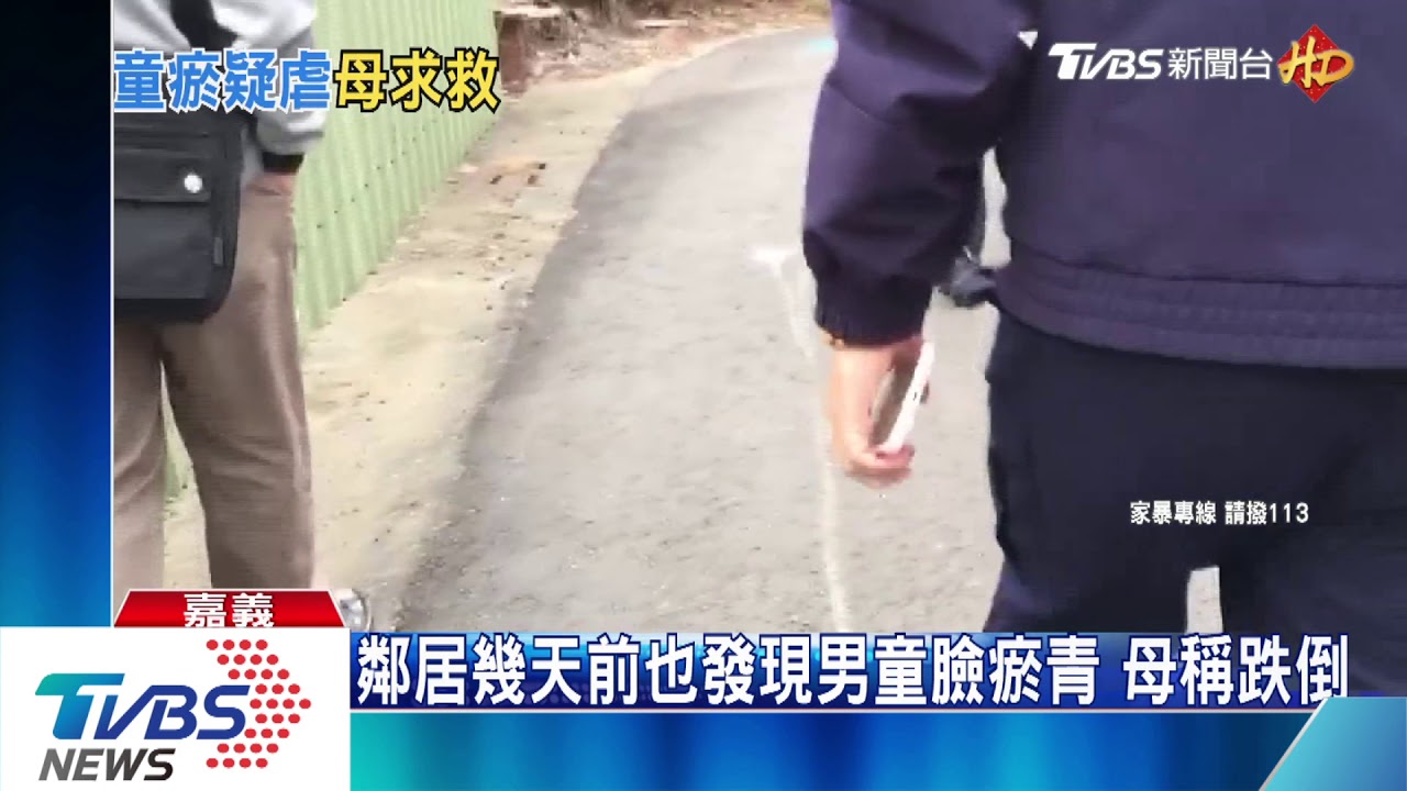 2歲兒疑遭繼父暴打 母po文求救警追查