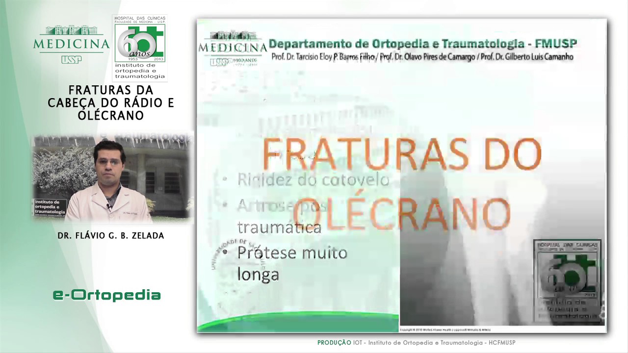 Fraturas da Cabeça do Rádio Olécrano - Dr. Flávio G.B. Zelada