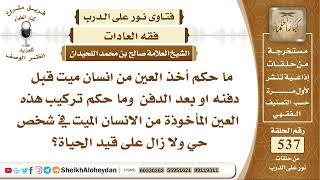 صورة 6636 -  حكم اخذ العين من انسان ميت قبل دفنه او بعد الدفن وتركيب هذه العين المأخوذة في شخص حي ولا زال
