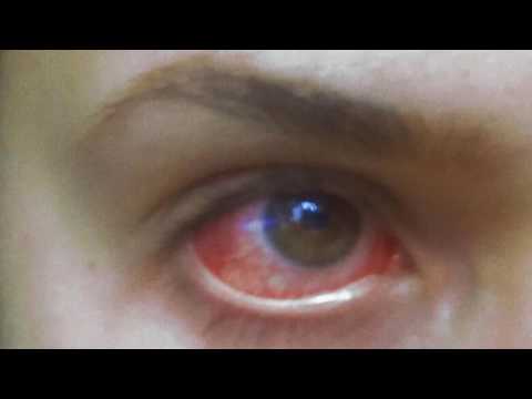 DYZPHORIA - all my friends are dead