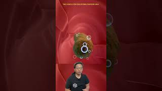 Download lagu INILAH KENAPA KITA BISA SEMBELIT 😱 #science #constipation #biology #doctor #didyouknow #animasi mp3