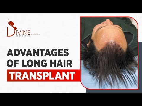 Best Surgeon Clinic For Long Hair Transplant In Delhi India At Low Cost  Price