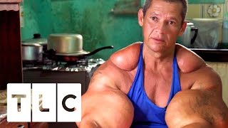 Bodybuilders Inject Muscles With Oil | Real Life Hulks