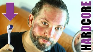 BARTROLLER / DERMAROLLER HARDCORE für bessere Ergebnisse | BARTWUCHS & HAUTVERJÜNGUNG – GREY YOUNG