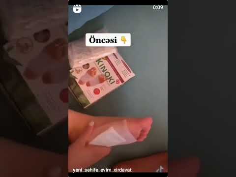 Kinoki Detox Foot Patches