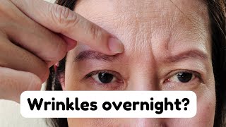 You can get Sleep wrinkles overnight?