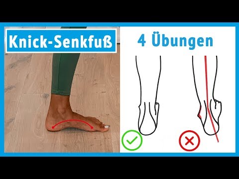 Knick-Senkfuß (Plattfuß) 🦶 4 Übungen für zu Hause