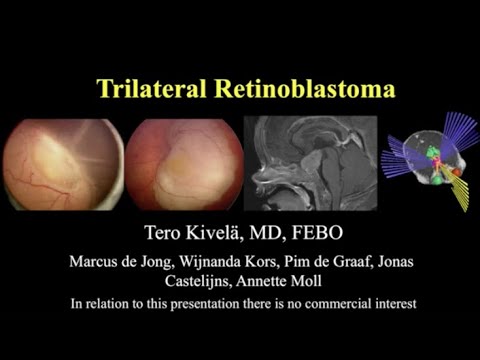 Retinoblastoma: Trilateral Retinoblastoma - Dr. Tero Kivela