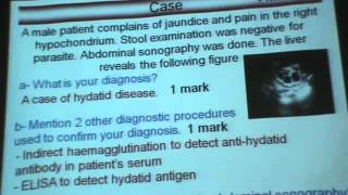 Dr Azza Parasitology Helminths Hymenolepis Infections Part 1