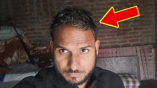 सर के डैंड्रफ को एक दिन में सही कर दिया 😱